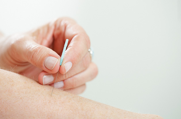 An acupuncturist at Jing River Acupuncture & Traditional Medicine in Edina inserts a needle into an arm.